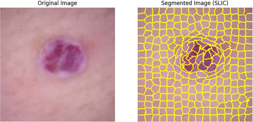 Image Segmentation